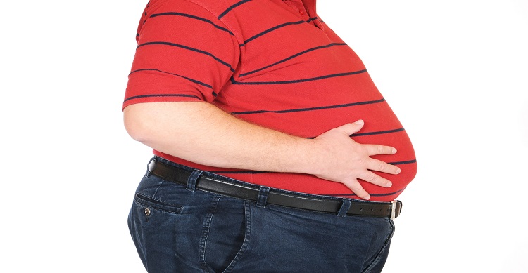Obesity and GERD, a heavy load indeed